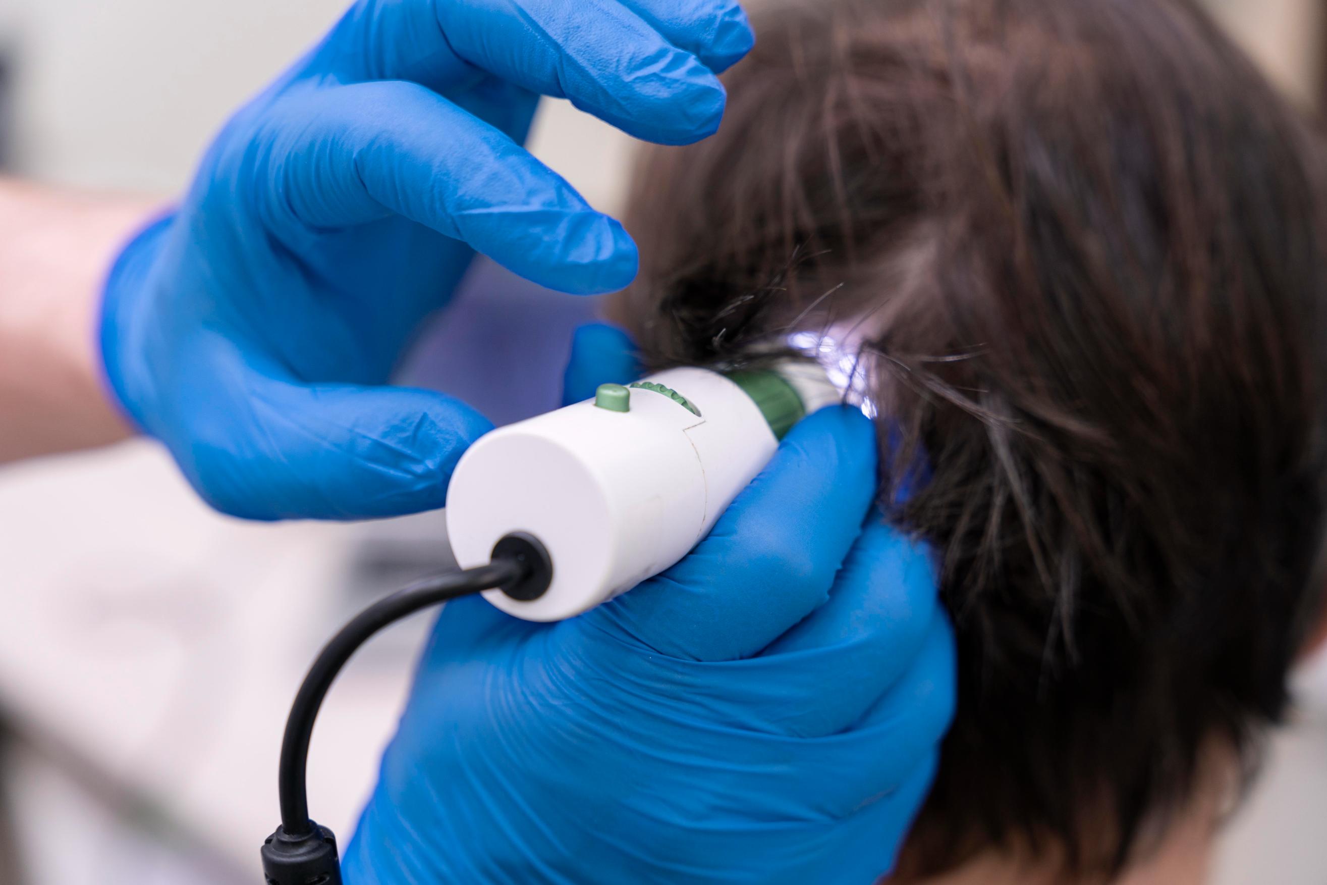 Hair Regeneration