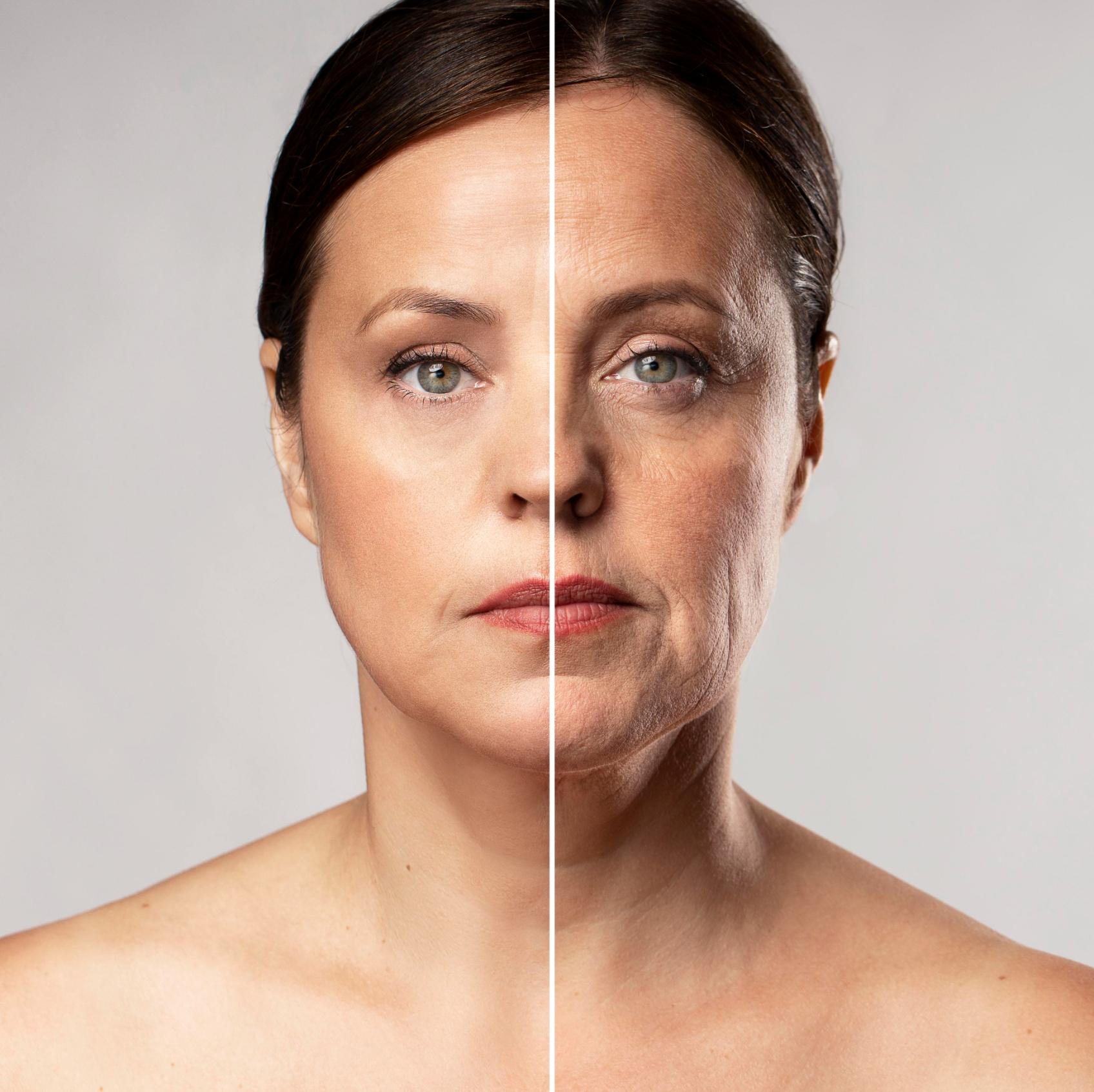 Skin Rejuvenation